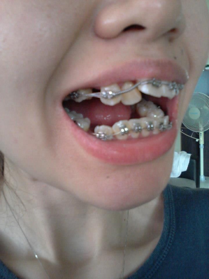  photo 149835_4247538141159_121695571_n_zps9b8a0ed6.jpg