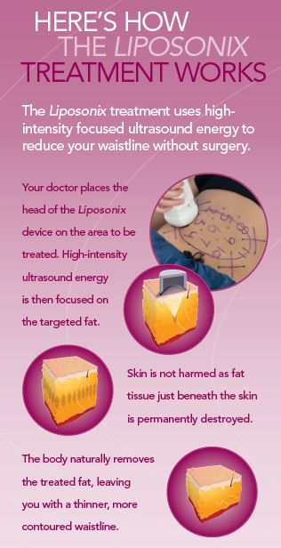 photo liposonix_zpsb2e37ddb.jpg