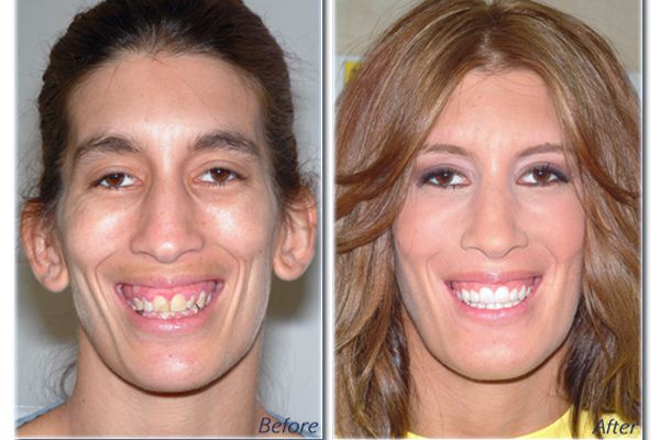  photo dentistry_zpsec31ae3f.jpg